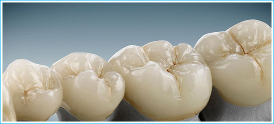 Metal Free Crown, Cad/Cam Crowns, Regular PFM Crowns, Dentists in Ahmedabad, Smilez Dental Clinic